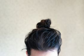 Greasy Hair in Bun on Top of Head